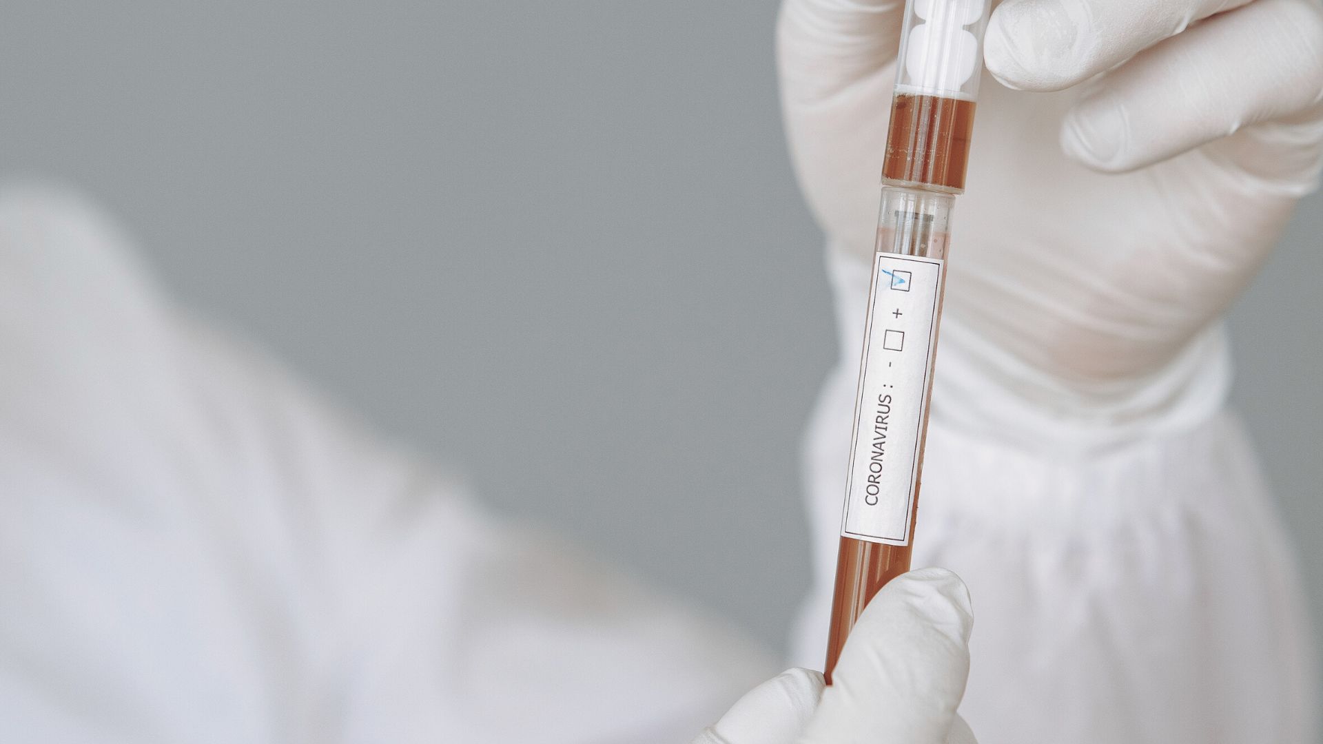 COVID-19 blood test