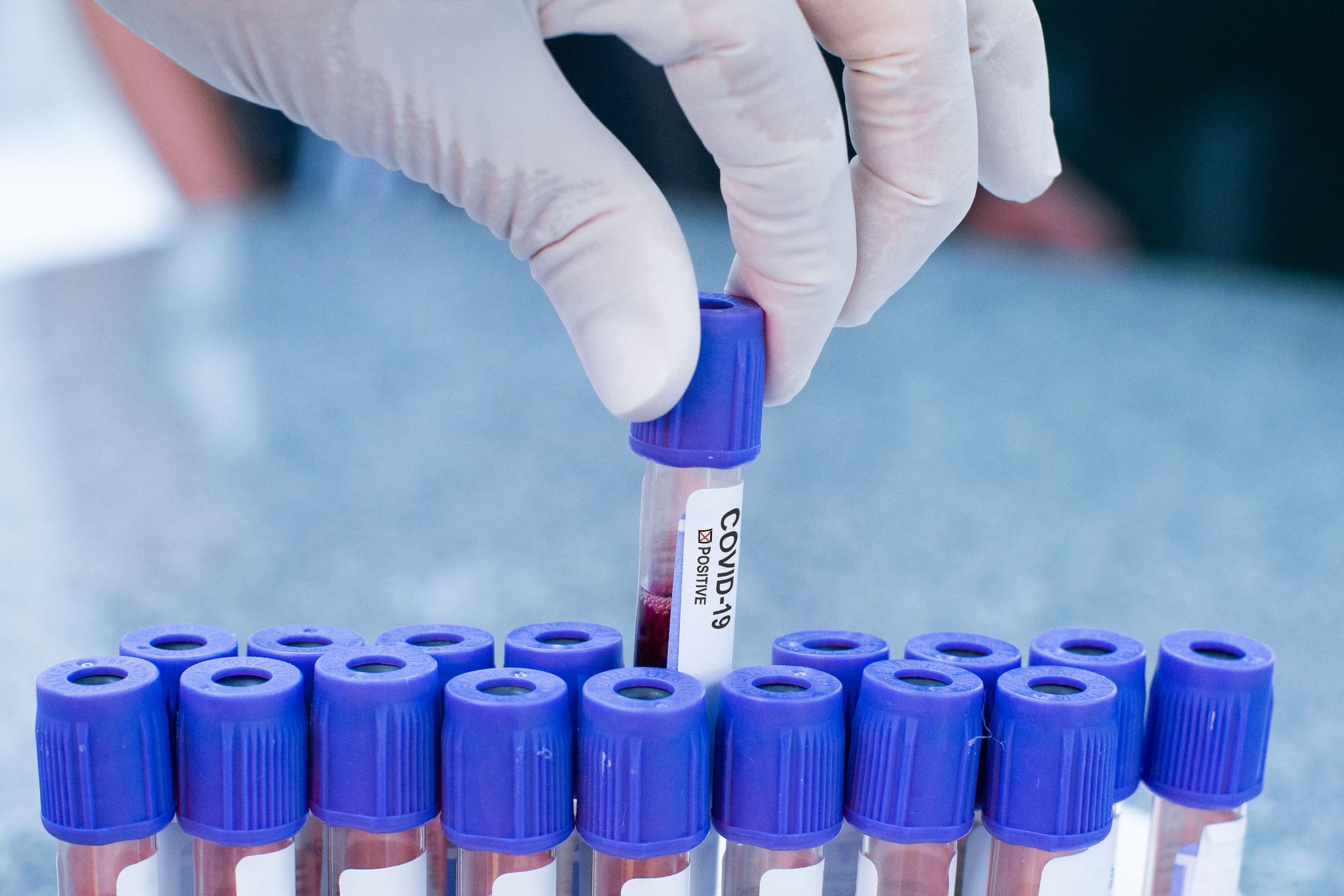 Coronavirus Testing