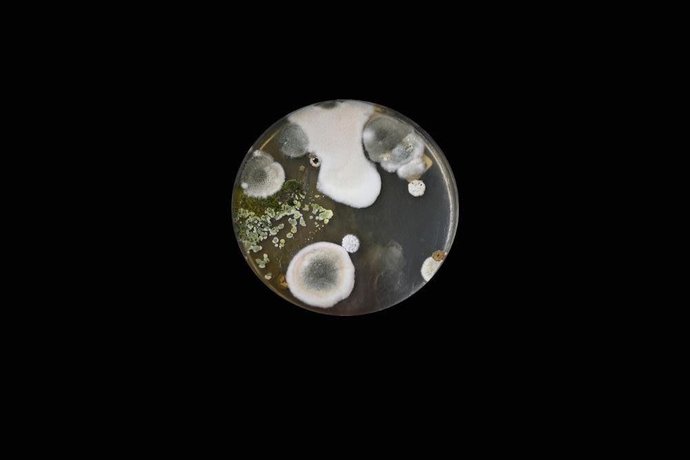 A petri dish against a black background, showing cultures of microbes from soil.