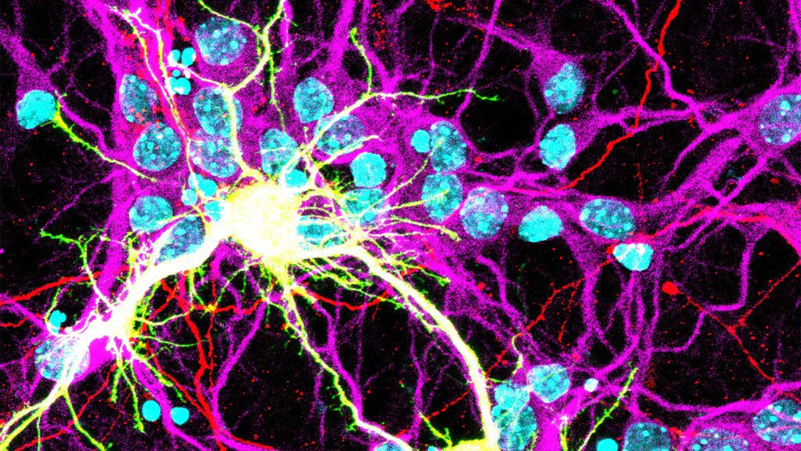 An image of fused neurons in yellow, expressing Spike S fusogen from the SARS-CoV-2 virus and the human receptor hACE2.
