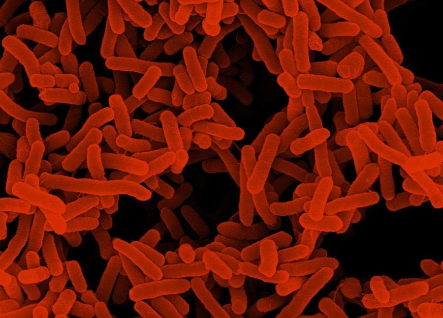 Microscopic image of bacteria