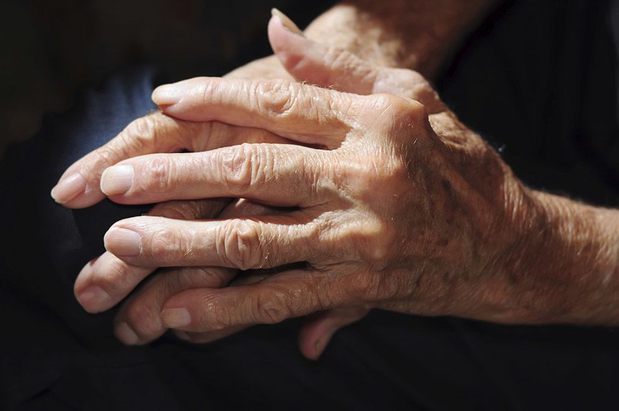 Arthritis is a chronic inflammatory disease.