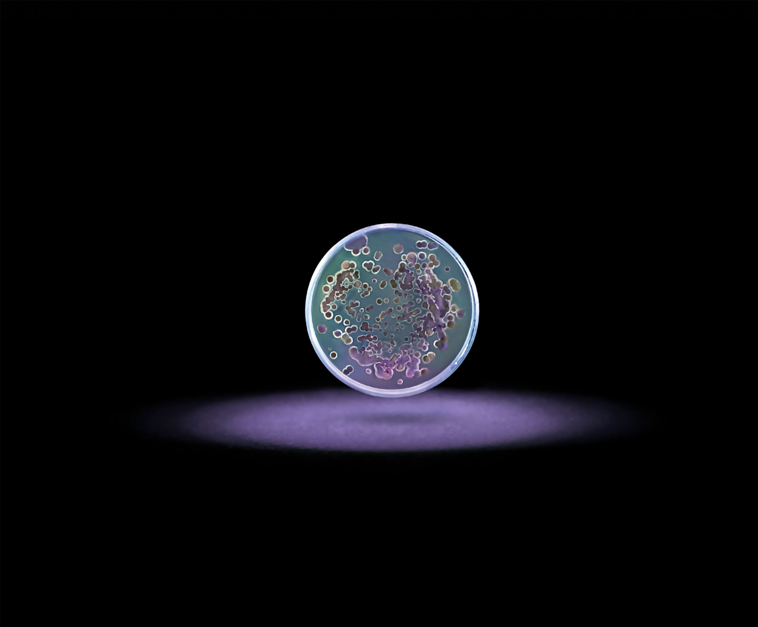 Image of microbes in a petri dish