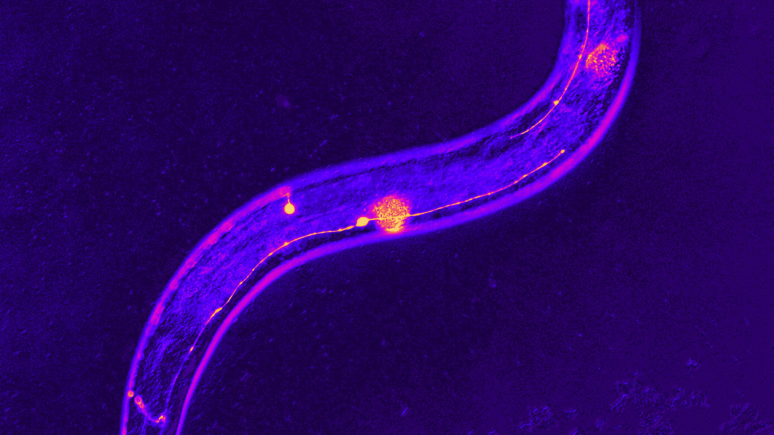 A purple scan of a worm's body