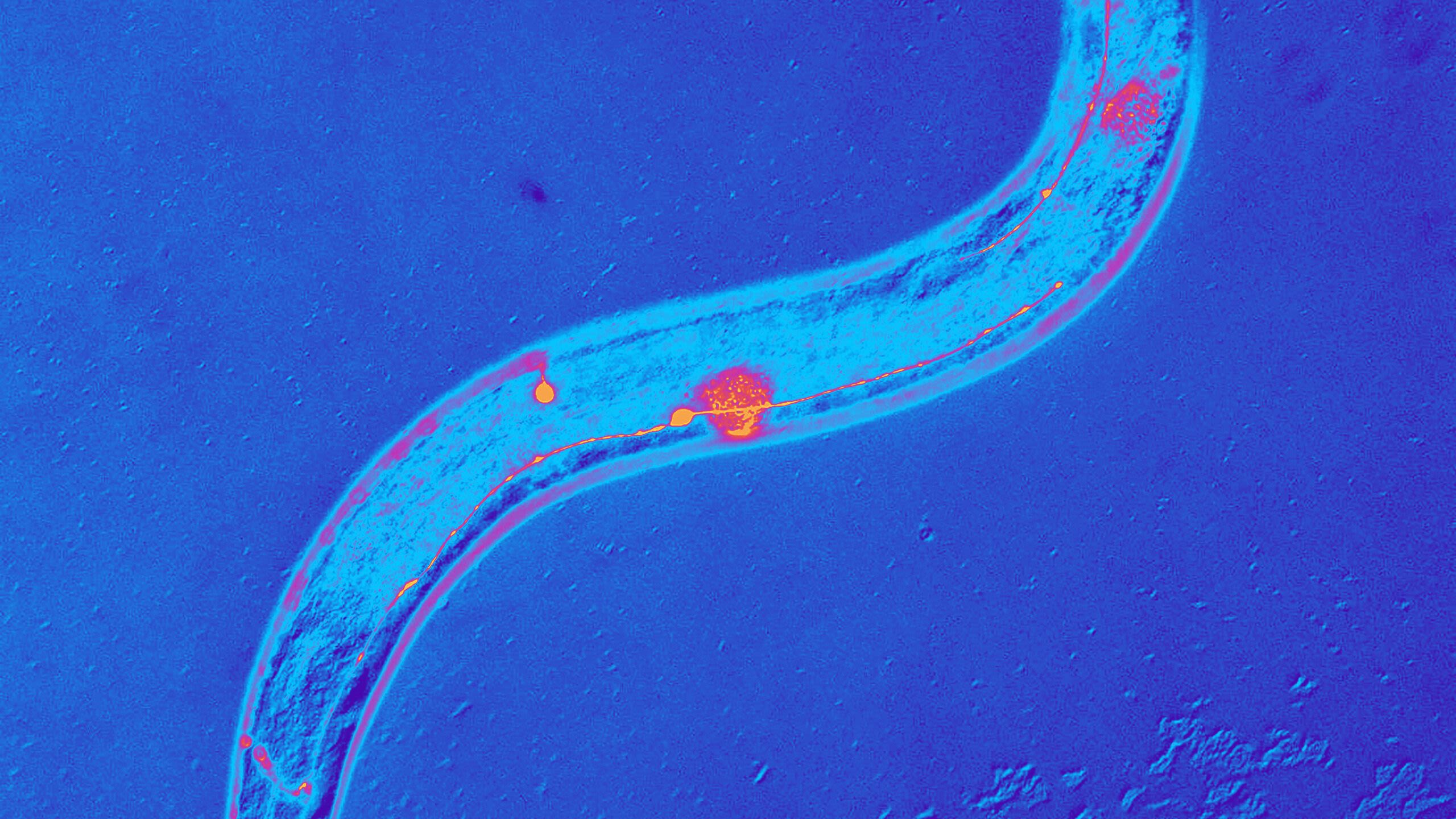A blue scan of a worm's body
