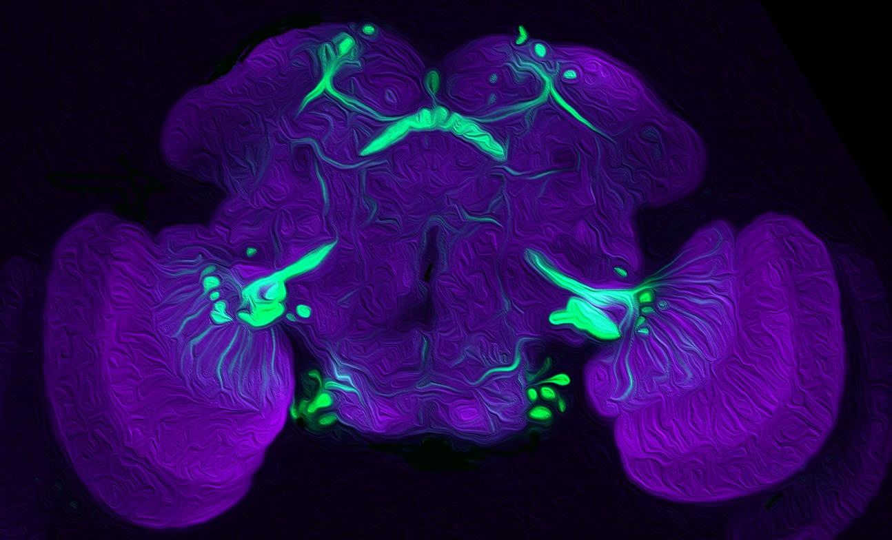 A close-up of cells from a fruit fly's brain