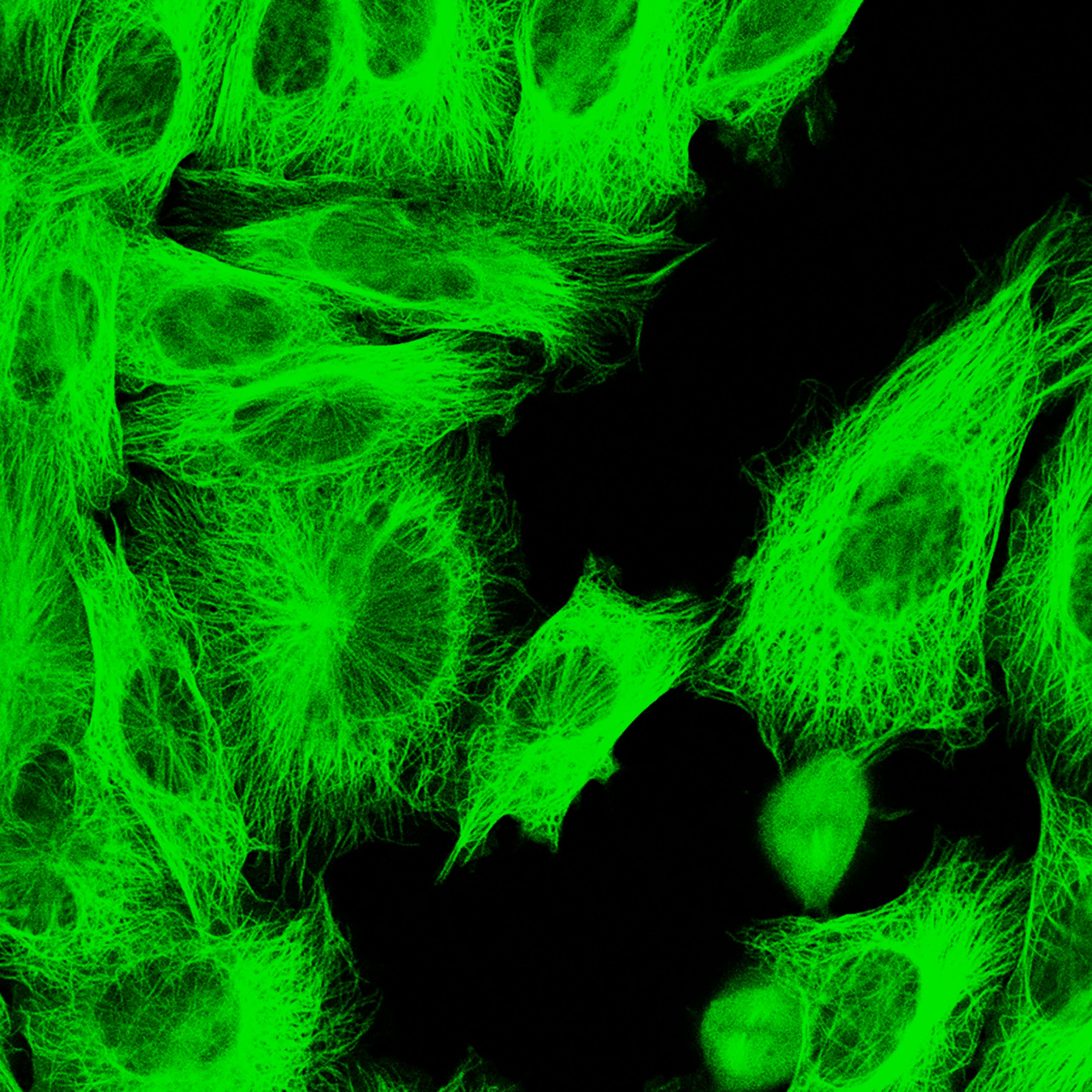 A close-up of fluorescent green web-like cells on a black background