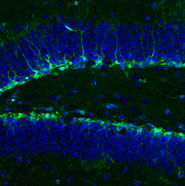 A close-up of vibrant blue and fluorescent green cells arranged in two solid lines with a valley between them