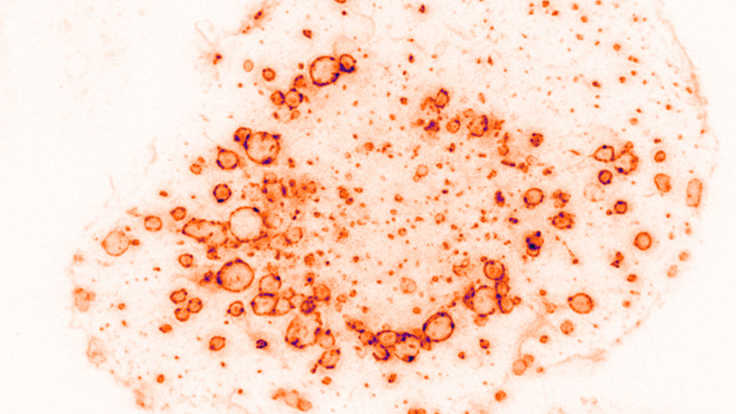 Close-up of red and yellow immune cells being observed with the help of a lipid specific label.