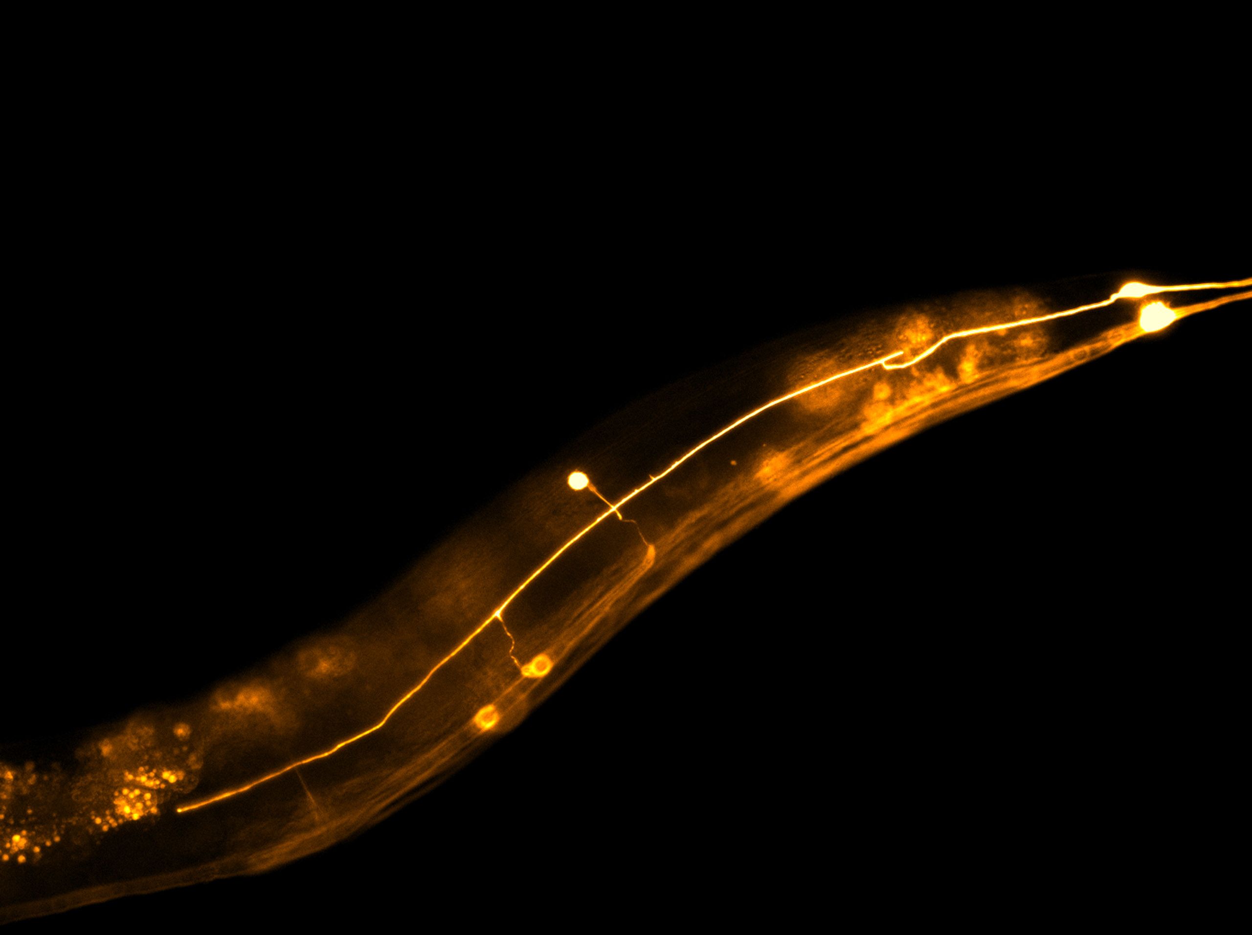 Neurons from C.elegans, the roundworm visualised under the microscope on a black background