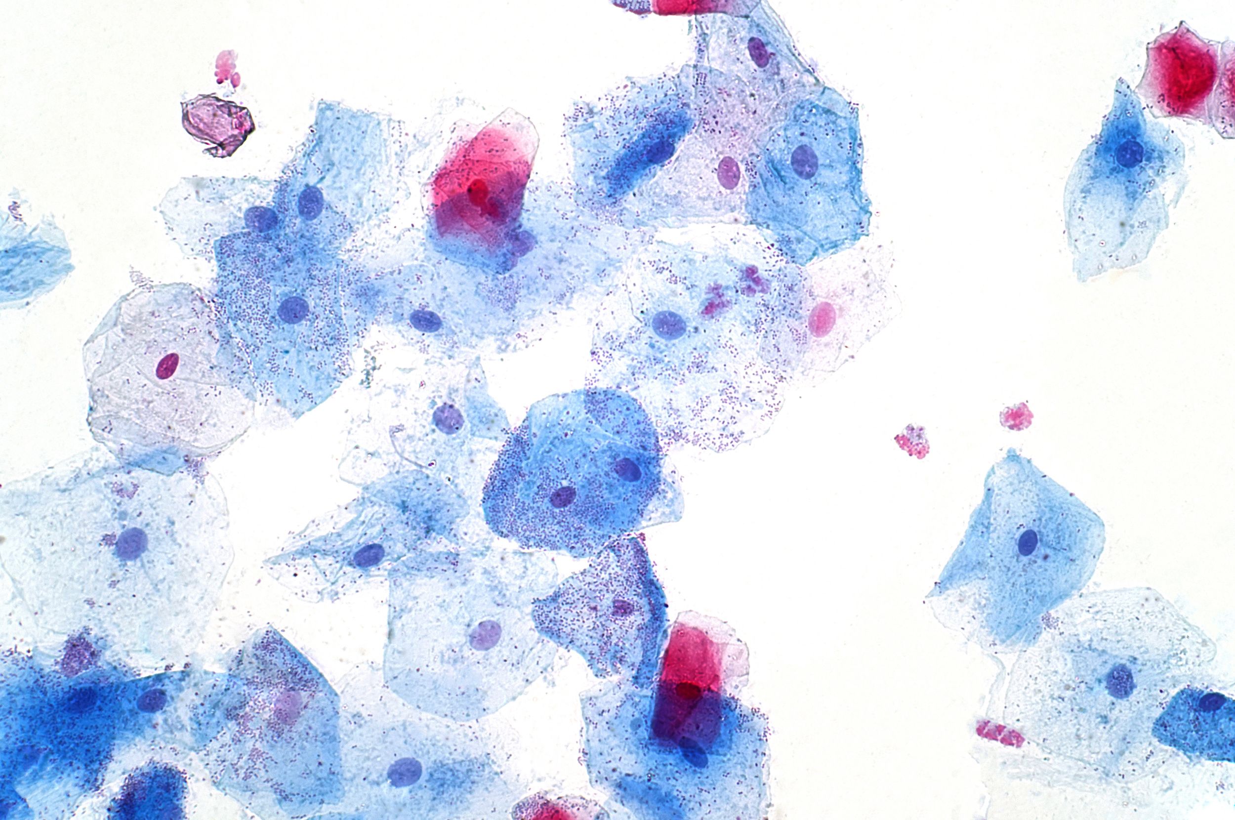 Slide of buccal mucosa cells