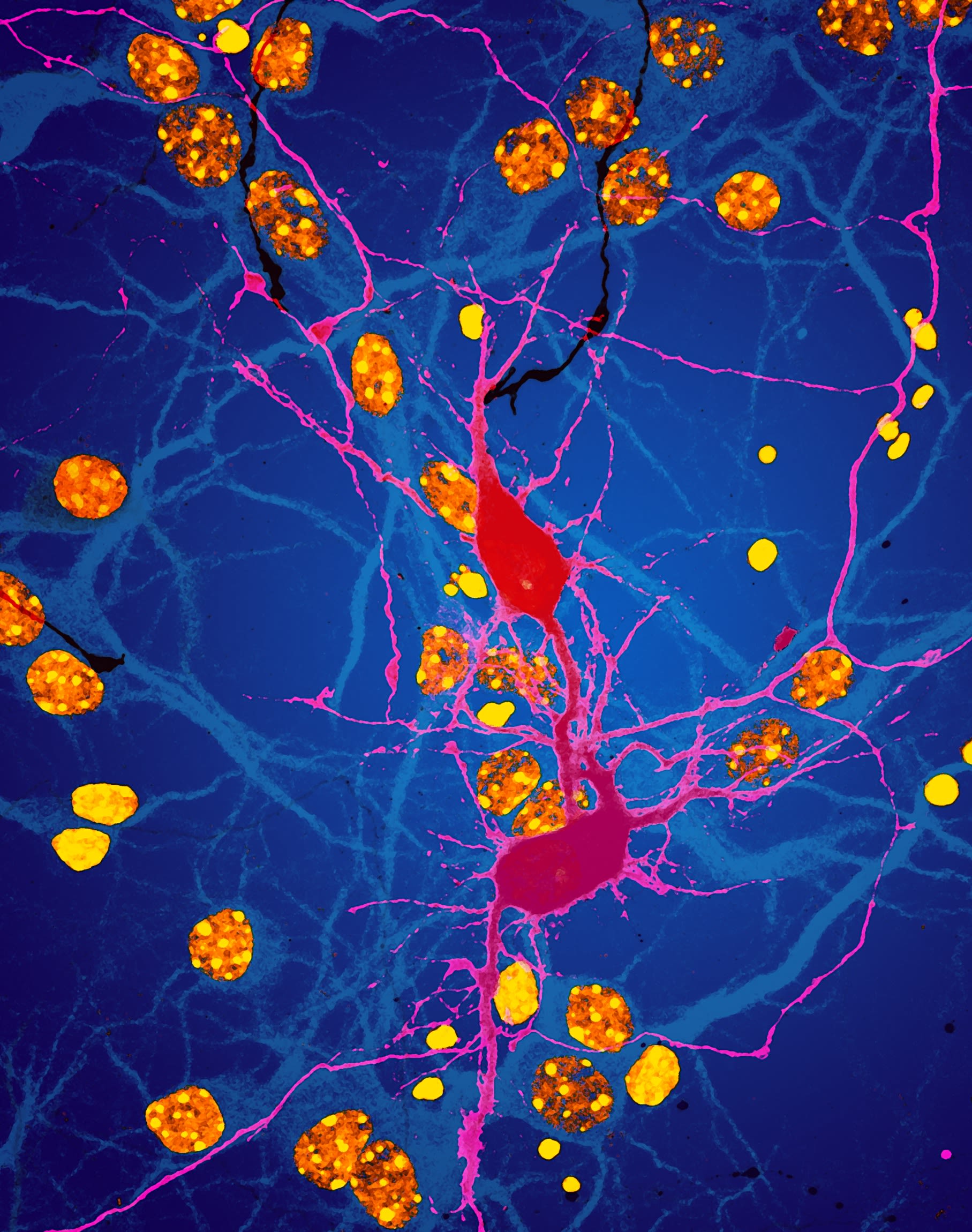 An image of fused neurons in the brain. Image: Dr Ramon Martinez-Marmol/Dr Nick Valmas.