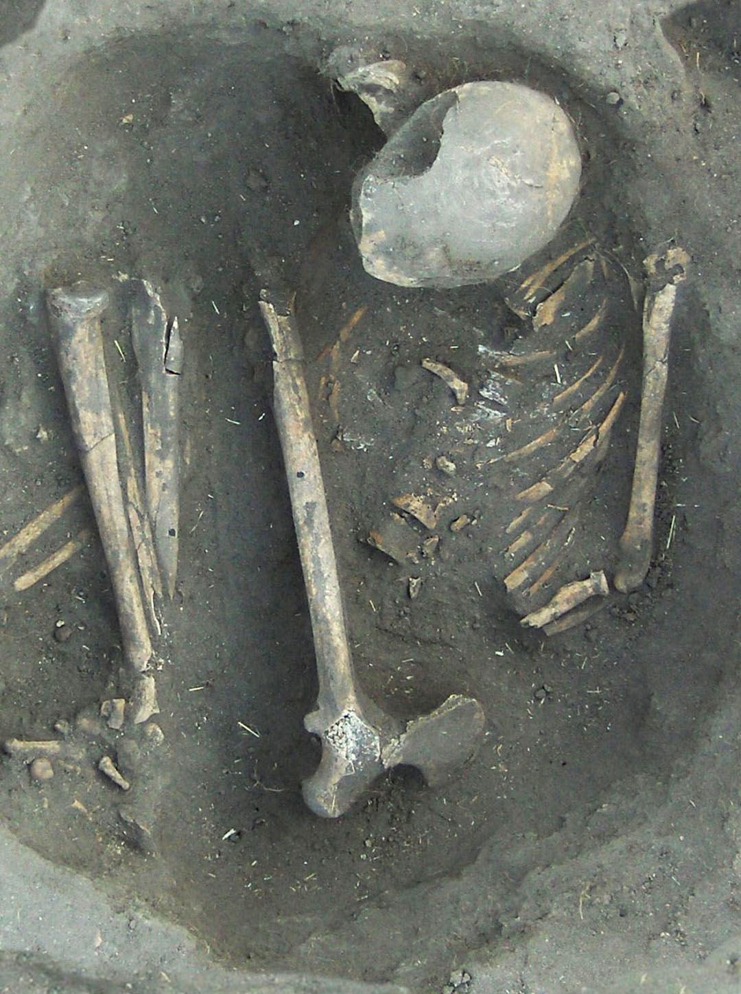 The partially excavated remains of a human skeleton.