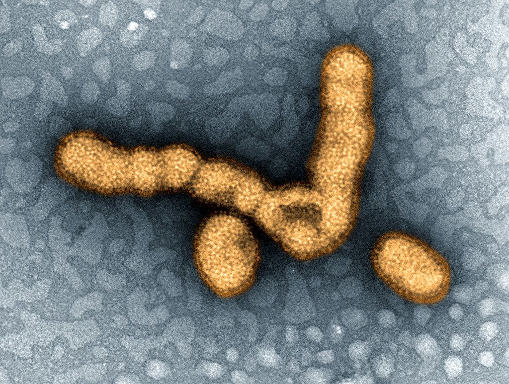 magnified image of virus