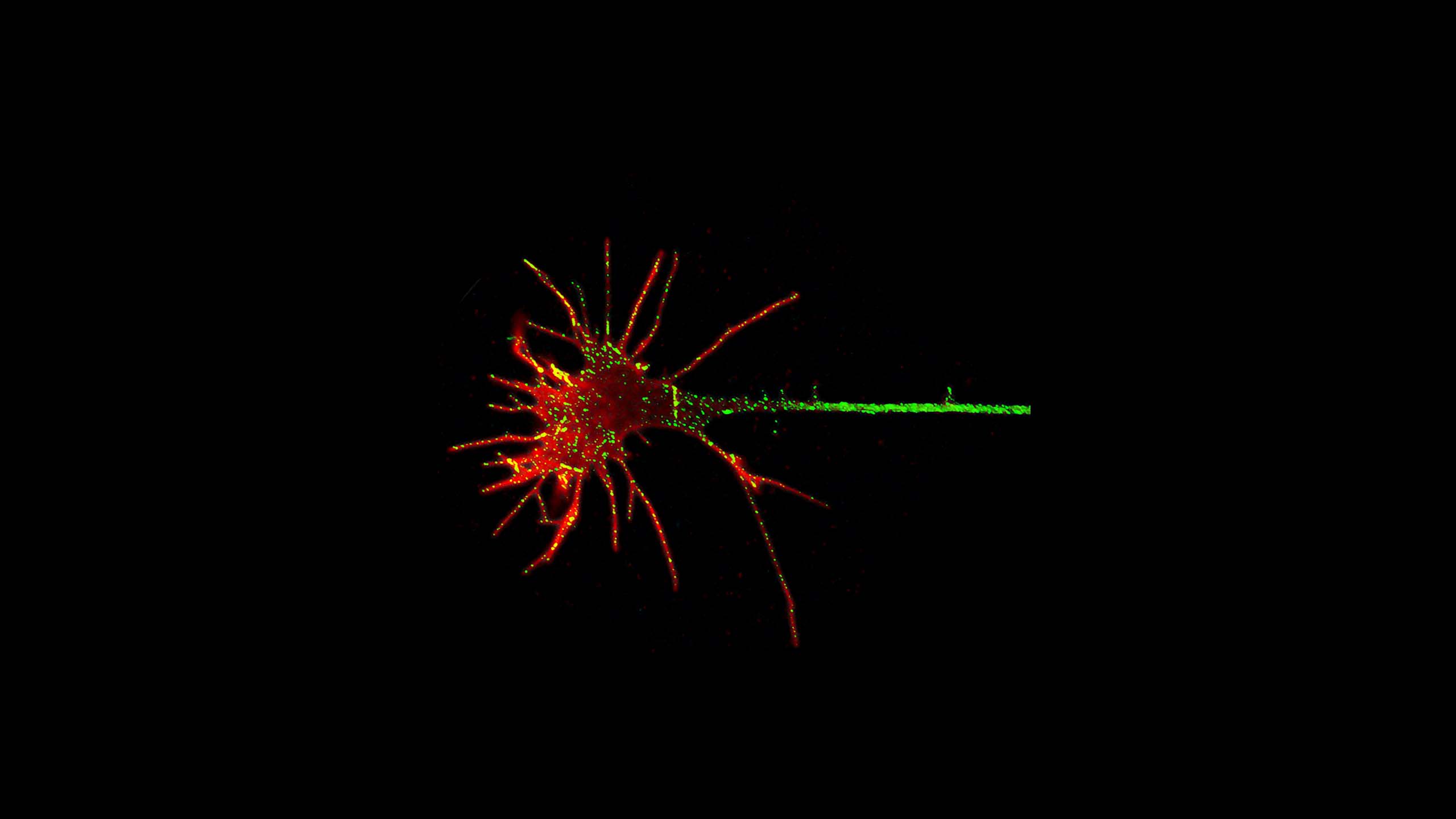 A red and green digital illustration of a neuron