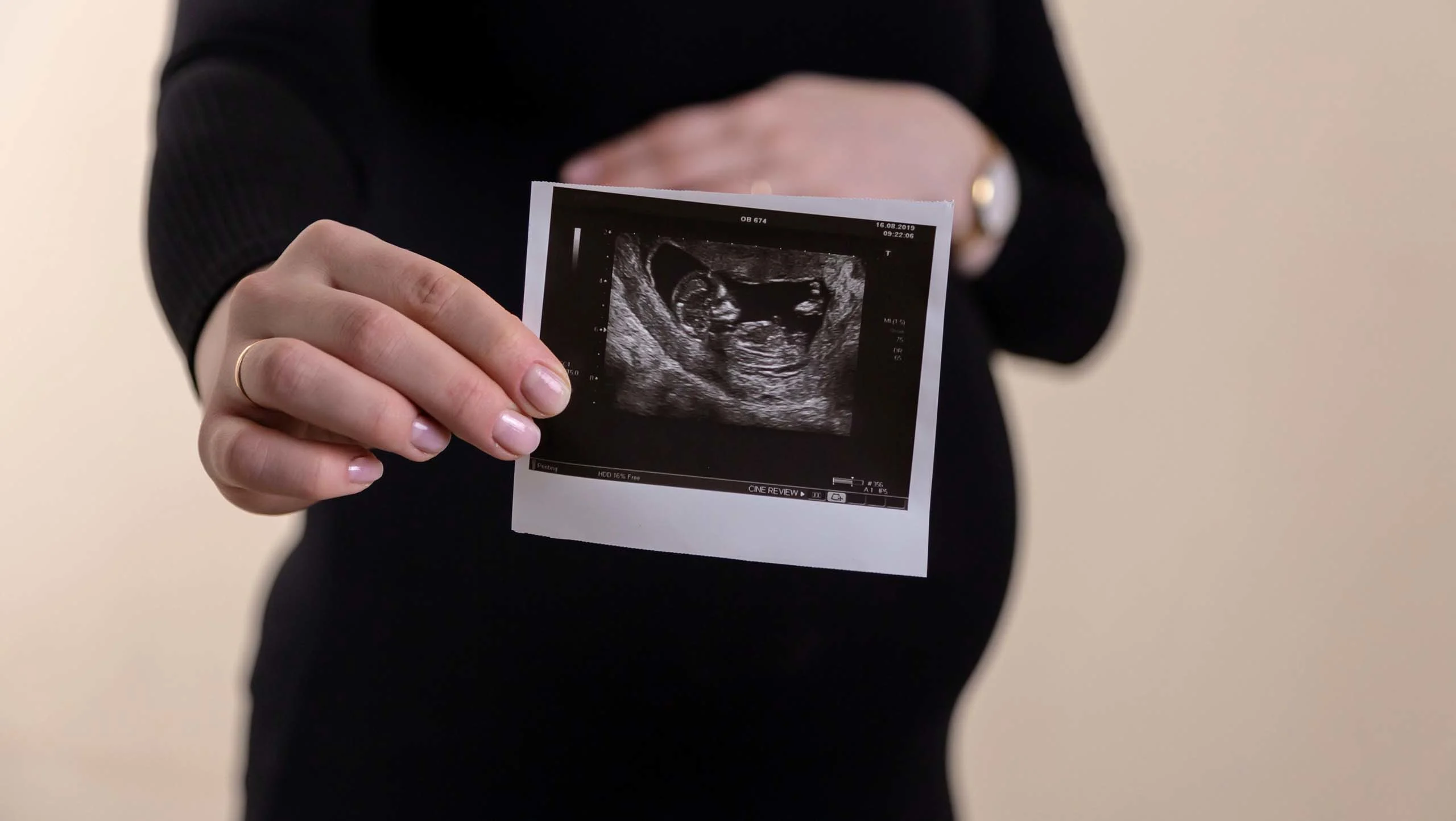 Pregnant woman holding up a small ultrasound of her baby