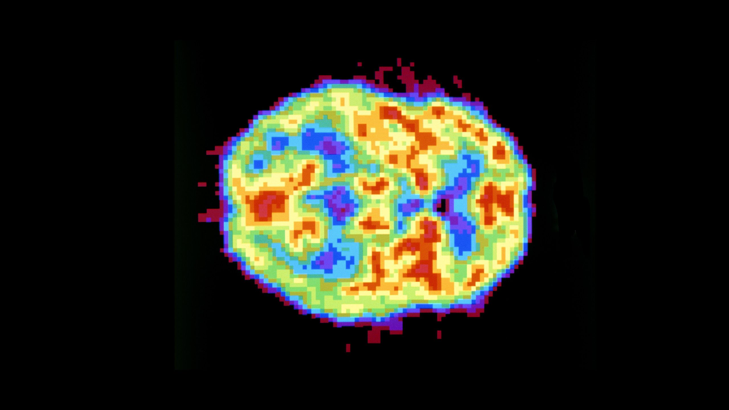 A heat map of the brain showing areas in different colours ranging from warm to cool colours.